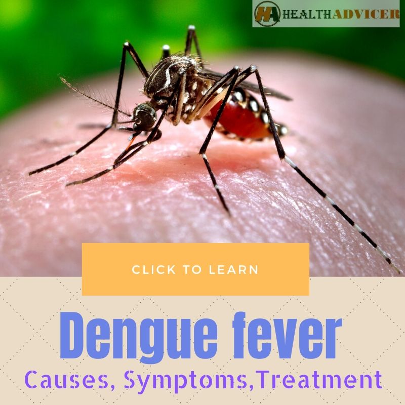 Dengue Fever Causes, Symptoms, Diagnosis And Treatment