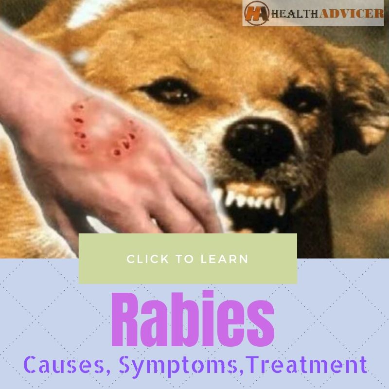 Sore Rabies Rabies: Types, Symptoms, Causes, Prevention And Treatments – QKZIZV